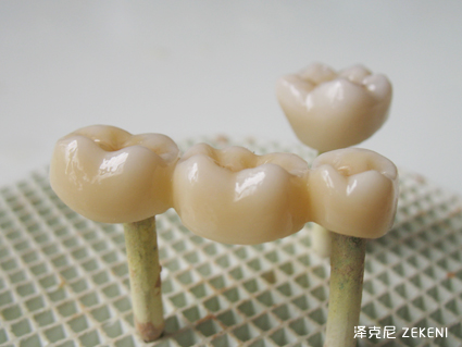 全锆渐变染色工艺-全锆作品